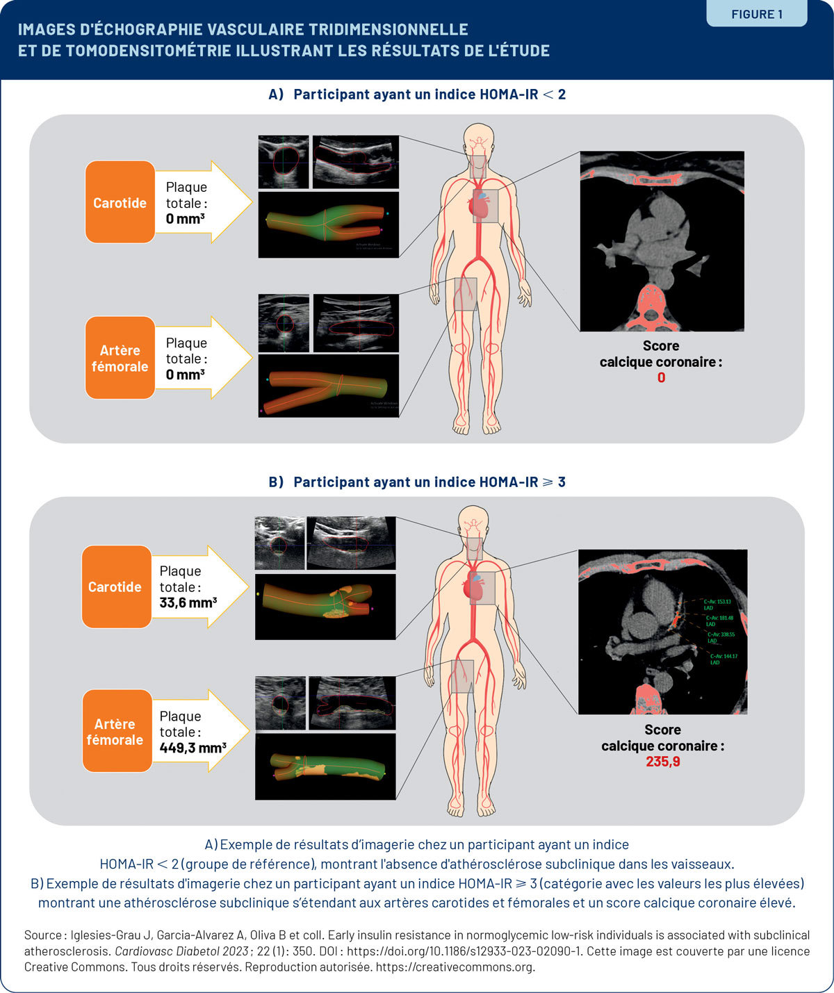 Viepro 0324 Insuline Figure1